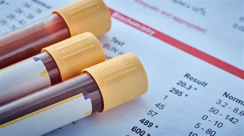 lister hospital blood test drop in|lister hospital blood test booking.